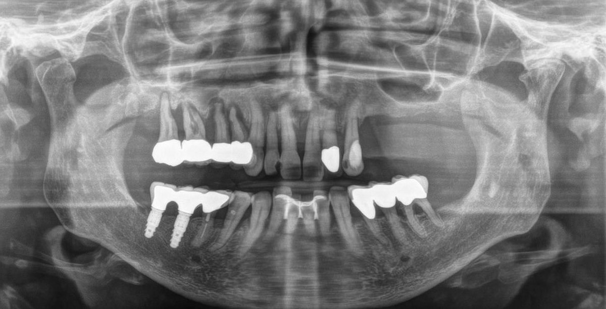 MountainView Dental MountainView Dental